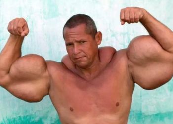 Adiós a ‘Popeye’: murió el fisicoculturista brasileño famoso por sus bíceps de 73 cm