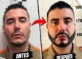 Polémica por presunta cirugía estética a alias Pichi dentro de una cárcel durante el gobierno Petro