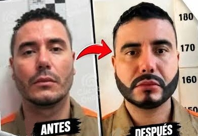 Polémica por presunta cirugía estética a alias Pichi dentro de una cárcel durante el gobierno Petro